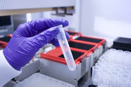 DNA- onderzoek