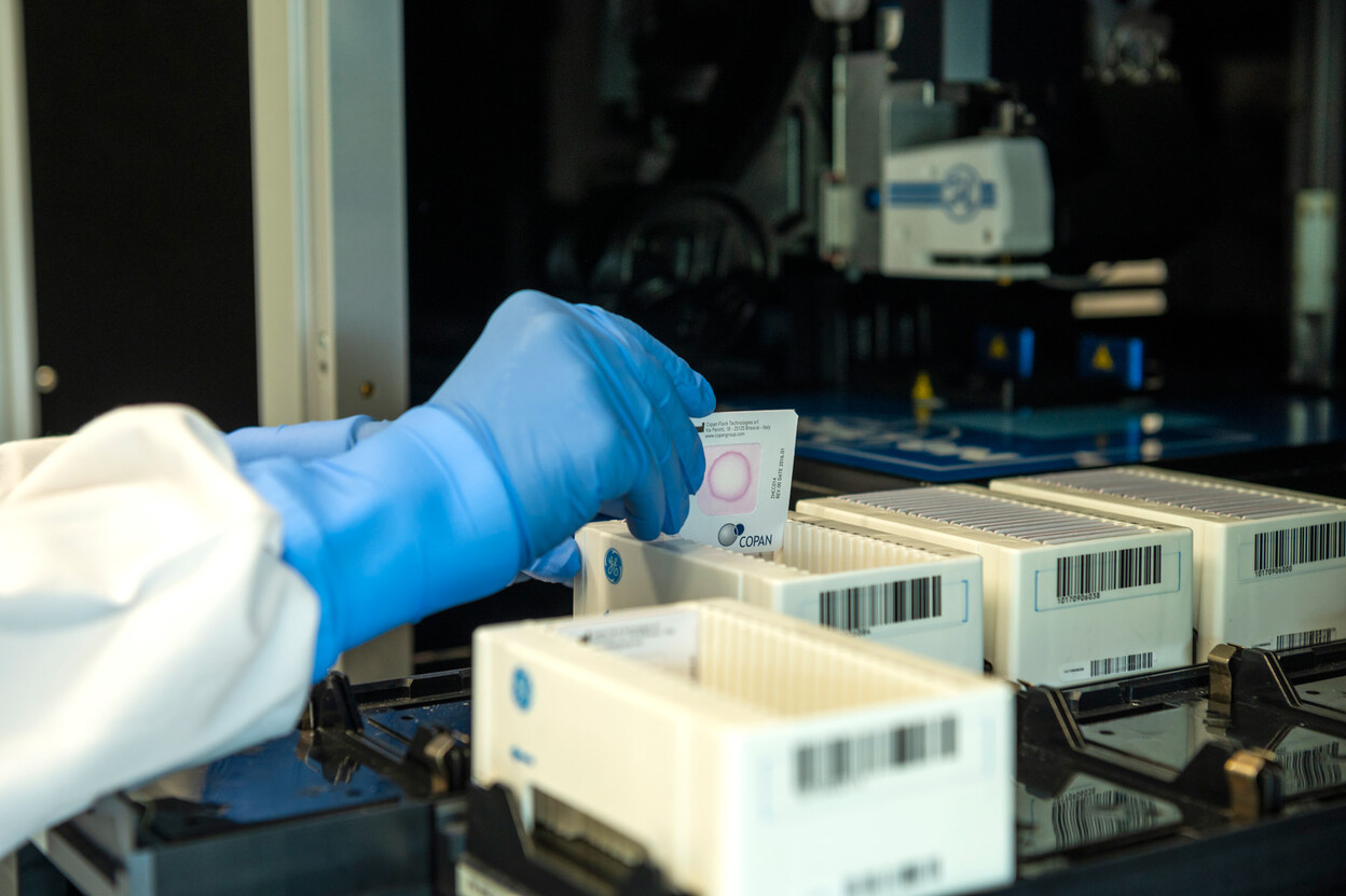 Onderzoeker plaatst referentiekaartjes van wangslijmvlies