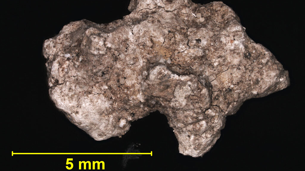 Miniscuul botdeeltje onder een microscoop