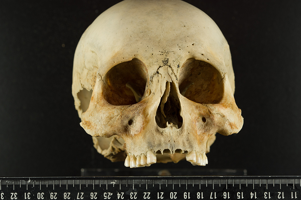 Voorkant van een gevonden schedel