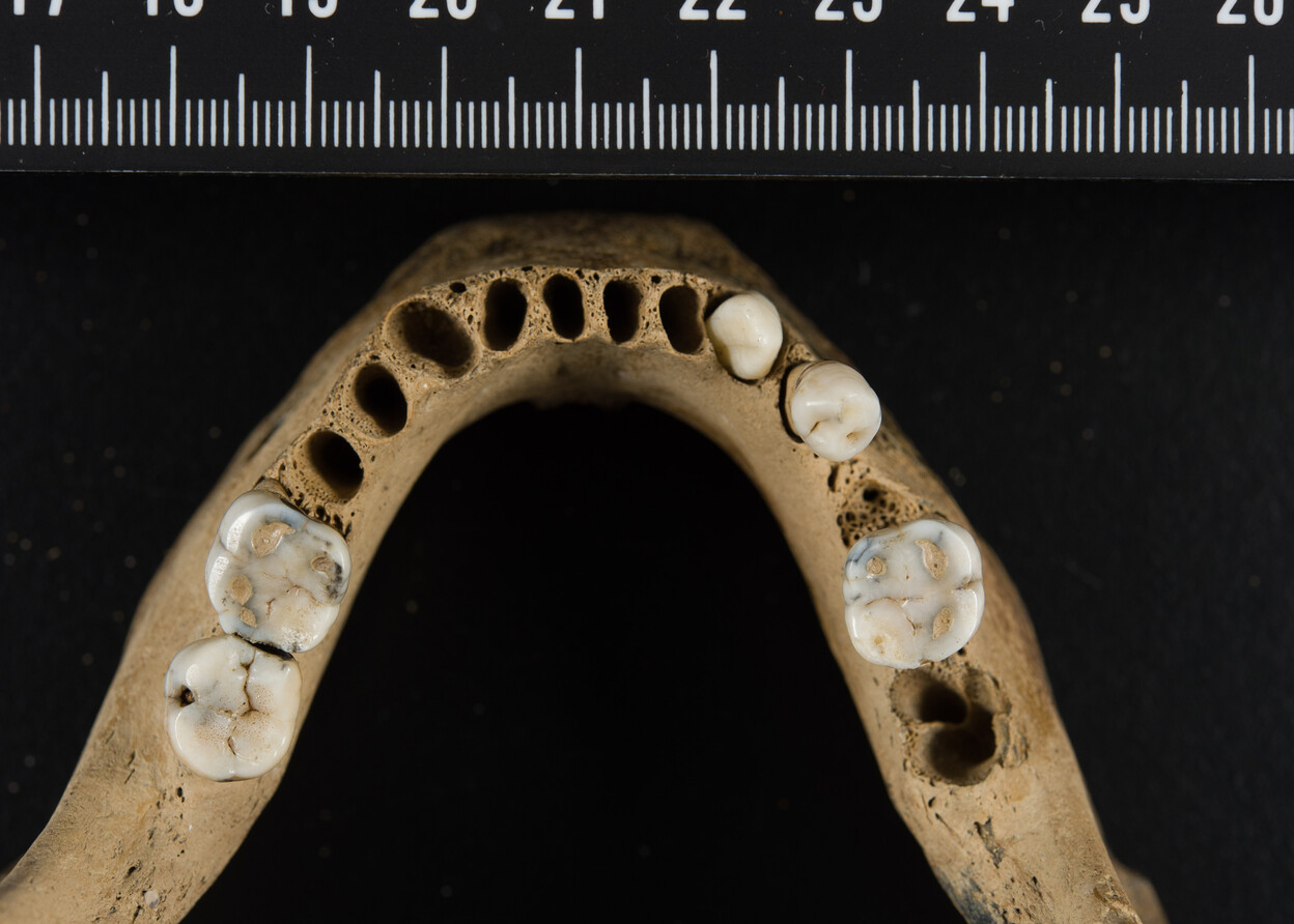 Onderkant van een kaak dat onderzocht wordt bij het NFI