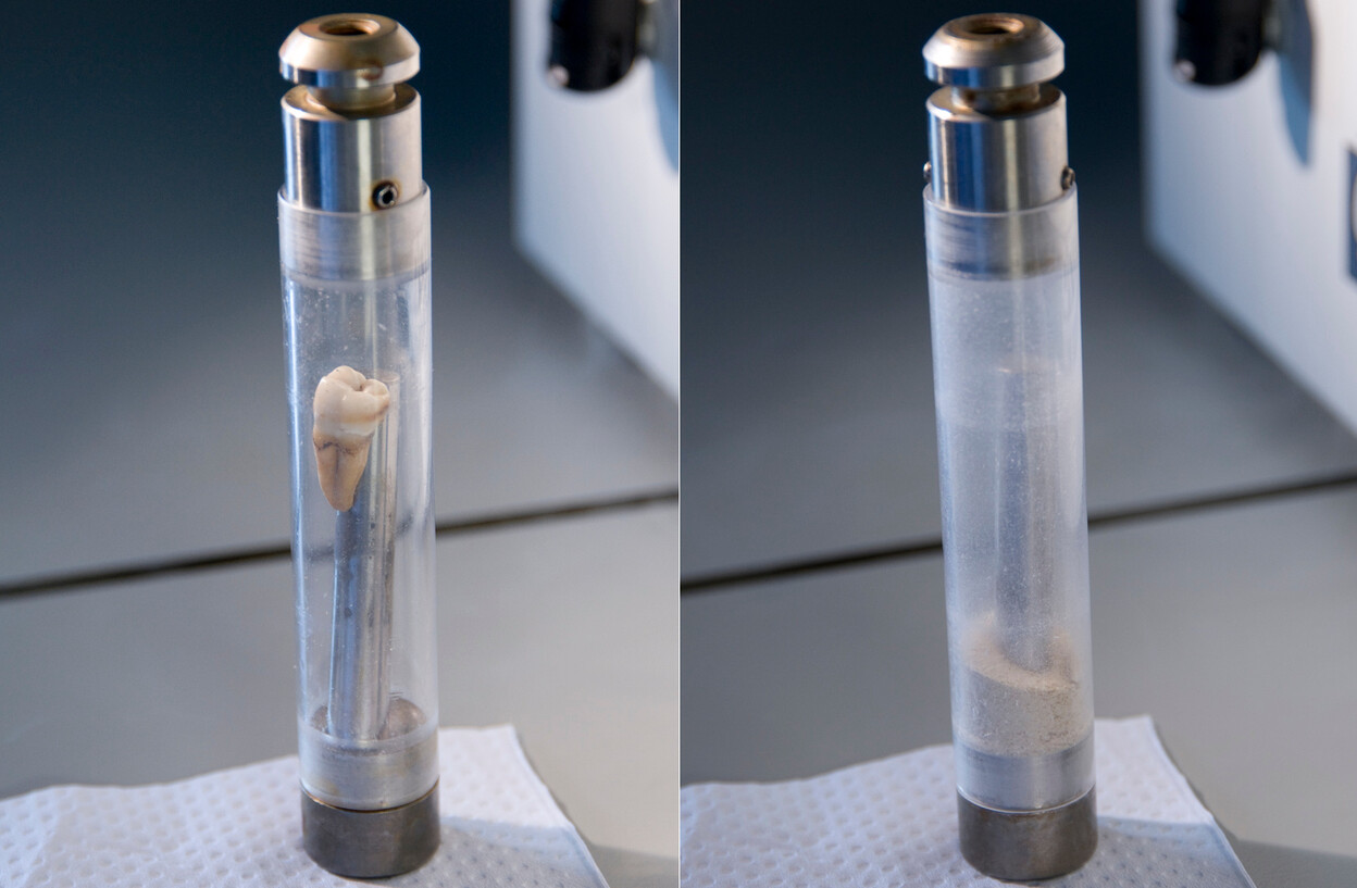 Een vermalen kies in een tube