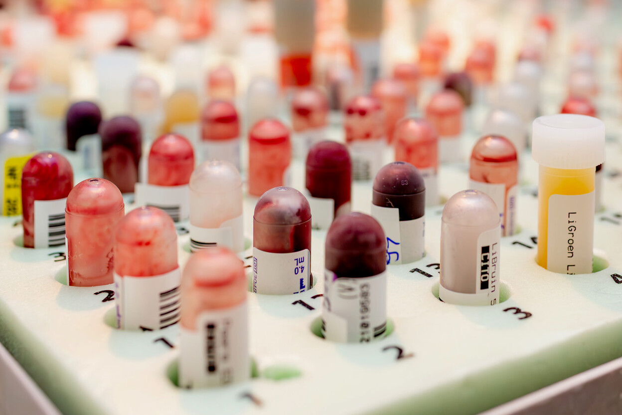 Close-up van buisjes met onder andere bloed in vriezerrek