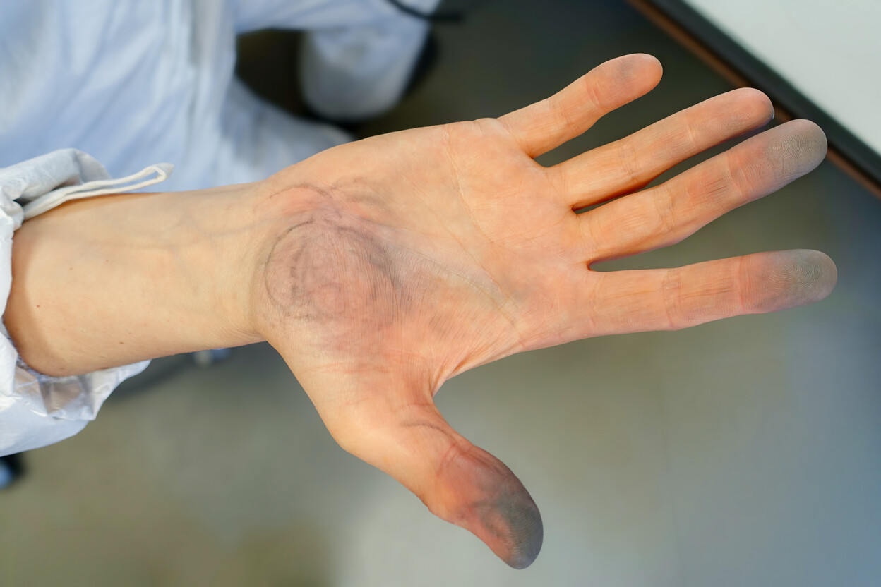 Zwarte vegen van flitspoeder op een hand